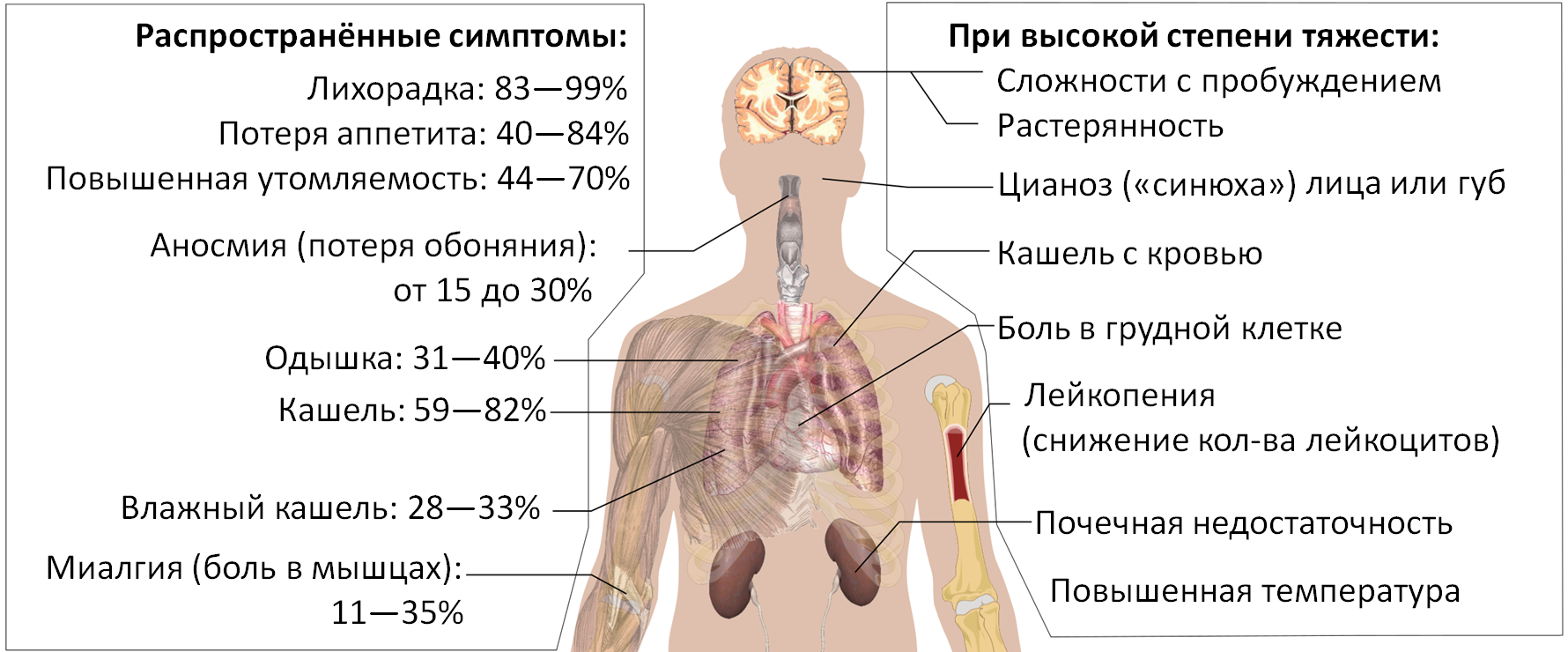 Symptoms of coronavirus disease 2019 4.0 ru